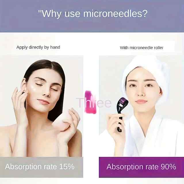 Мезоролер 540 голок для омолодження, відновлення та проникнення косметики - 2 фото товару